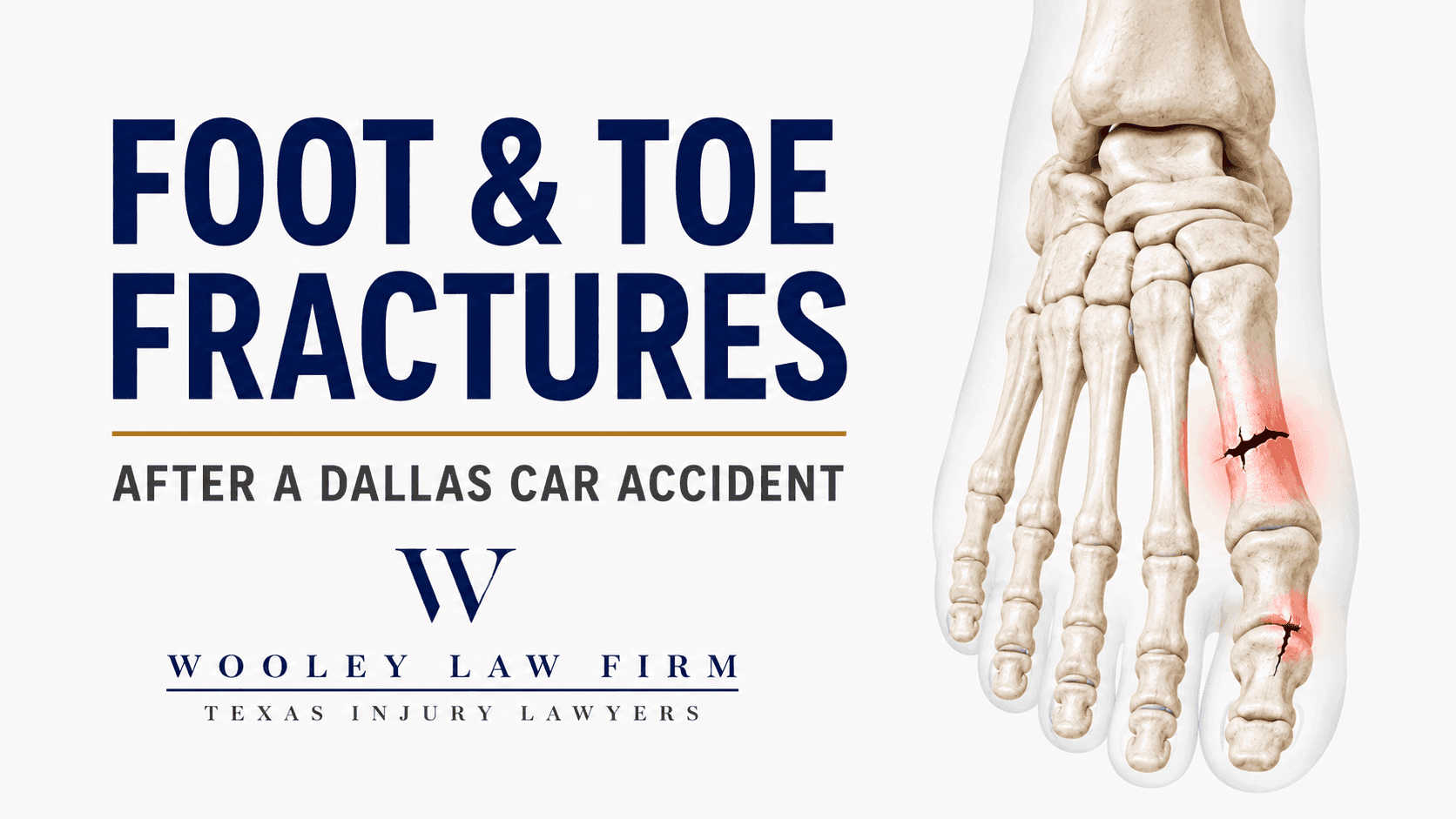 Foot and Toe Fractures After a Dallas Car Accident: Tarsal, Metatarsal, and Toe Injuries